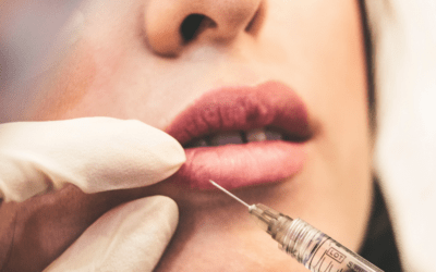 Lip Fillers: Everything You Need to Know