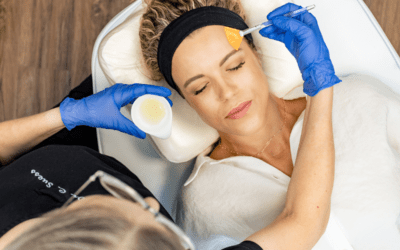 Facials vs Chemical Peels: Know the Difference