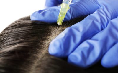 Unveiling the Power of Platelet-Rich Plasma for Hair Rejuvenation
