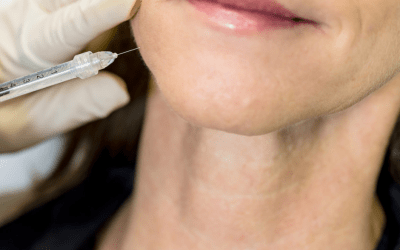 Lip Filler Without the Ouch: Our Modified Dental Block Technique